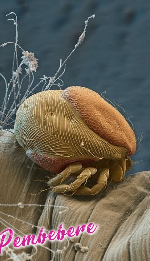 Böceklerin Mikroskopta Görünümü - Hakkında Geniş Bilgi Pembebere.com